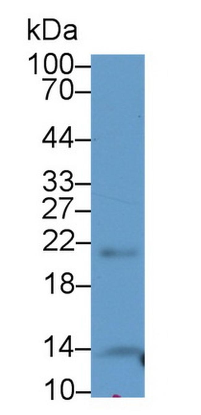 THRSP Antibody in Western Blot (WB)