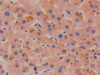 SERPINA7 Antibody in Immunohistochemistry (Paraffin) (IHC (P))