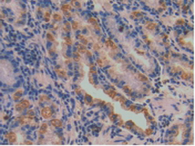 SERPINA7 Antibody in Immunohistochemistry (Paraffin) (IHC (P))