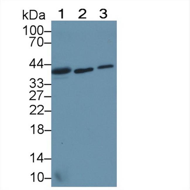 TSTA3 Antibody in Western Blot (WB)