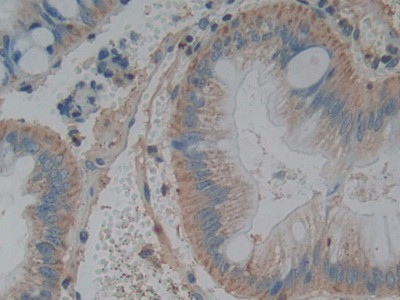 TL1A Antibody in Immunohistochemistry (Paraffin) (IHC (P))