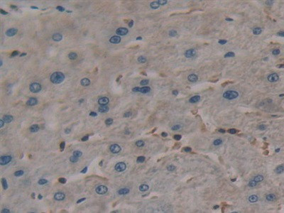 TL1A Antibody in Immunohistochemistry (Paraffin) (IHC (P))