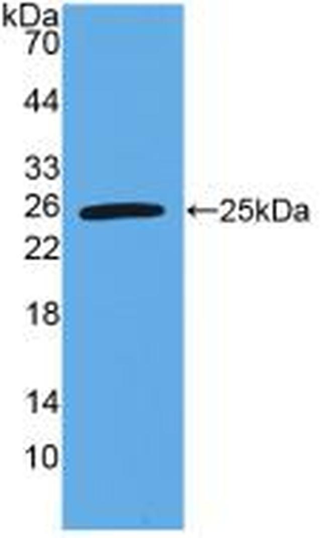 TL1A Antibody in Western Blot (WB)