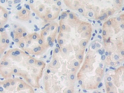 TRAF4 Antibody in Immunohistochemistry (Paraffin) (IHC (P))