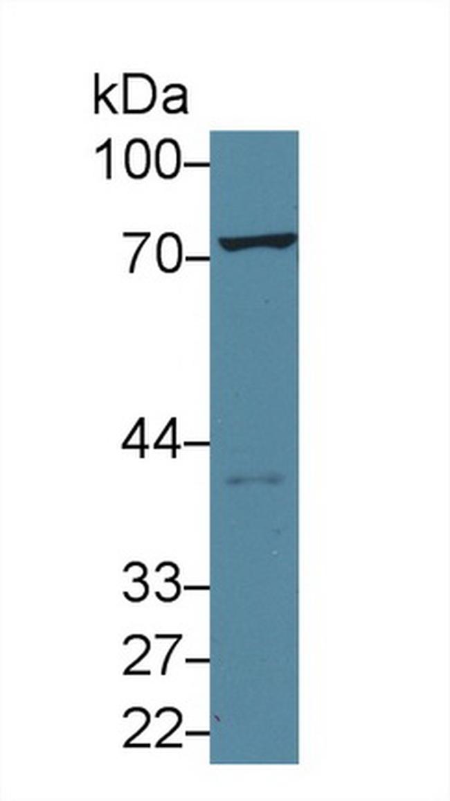 TGM2 Antibody in Western Blot (WB)