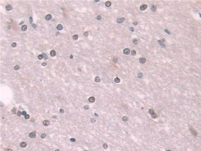 Transketolase Antibody in Immunohistochemistry (Paraffin) (IHC (P))