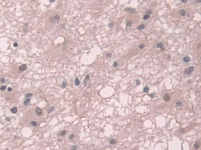 Transketolase Antibody in Immunohistochemistry (Paraffin) (IHC (P))