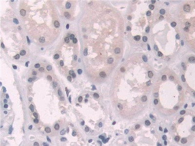 Transketolase Antibody in Immunohistochemistry (Paraffin) (IHC (P))