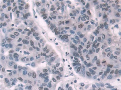 Transketolase Antibody in Immunohistochemistry (Paraffin) (IHC (P))