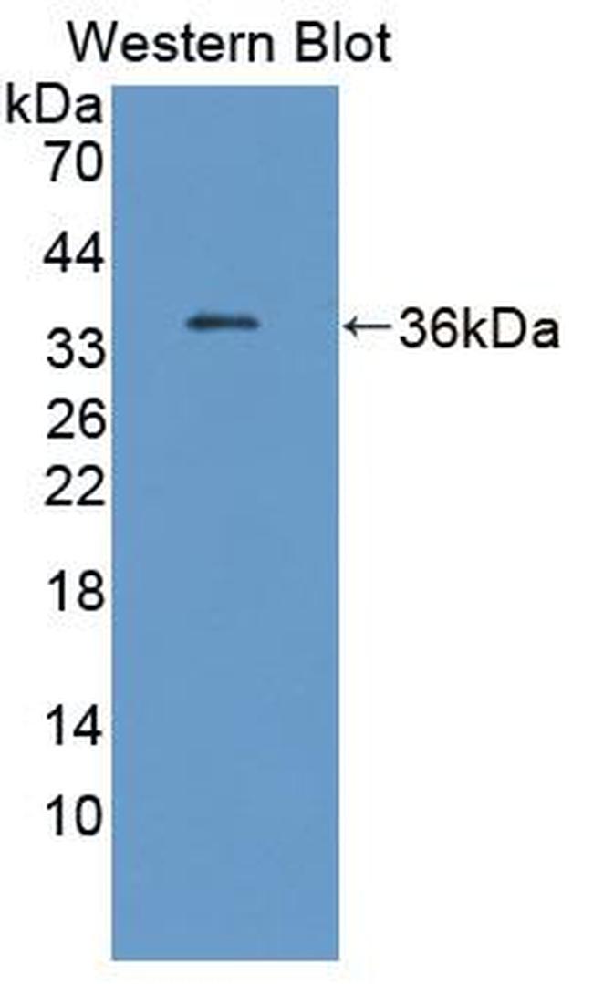 Transketolase Antibody in Western Blot (WB)