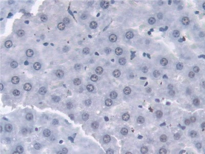 Transketolase Antibody in Immunohistochemistry (Paraffin) (IHC (P))