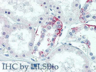 TMEM27 Antibody in Immunohistochemistry (Paraffin) (IHC (P))