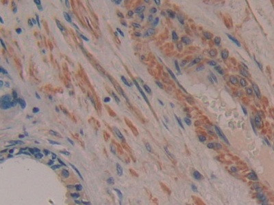 TTK Antibody in Immunohistochemistry (Paraffin) (IHC (P))