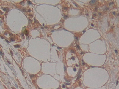 TTK Antibody in Immunohistochemistry (Paraffin) (IHC (P))