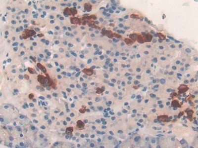 TUBD1 Antibody in Immunohistochemistry (Paraffin) (IHC (P))