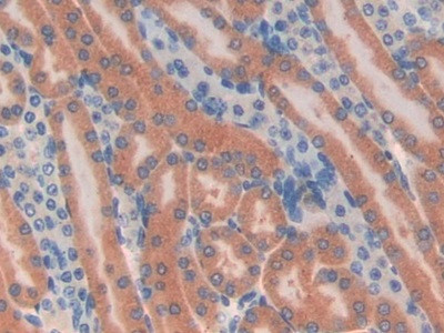 TUBD1 Antibody in Immunohistochemistry (Paraffin) (IHC (P))