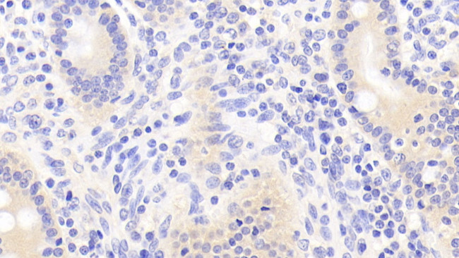 TUBD1 Antibody in Immunohistochemistry (Paraffin) (IHC (P))