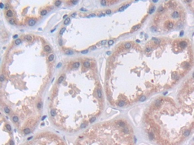 TUBD1 Antibody in Immunohistochemistry (Paraffin) (IHC (P))