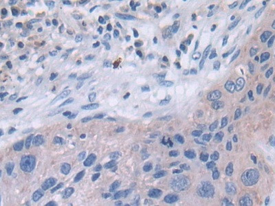 TUBD1 Antibody in Immunohistochemistry (Paraffin) (IHC (P))