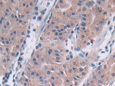 TUBD1 Antibody in Immunohistochemistry (Paraffin) (IHC (P))