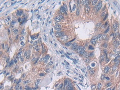 TUBD1 Antibody in Immunohistochemistry (Paraffin) (IHC (P))