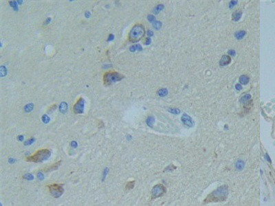 TNFR1 Antibody in Immunohistochemistry (Paraffin) (IHC (P))