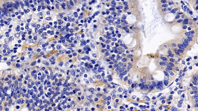 TNFR1 Antibody in Immunohistochemistry (Paraffin) (IHC (P))