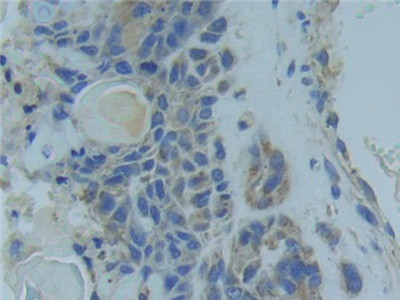 TNFR1 Antibody in Immunohistochemistry (Paraffin) (IHC (P))