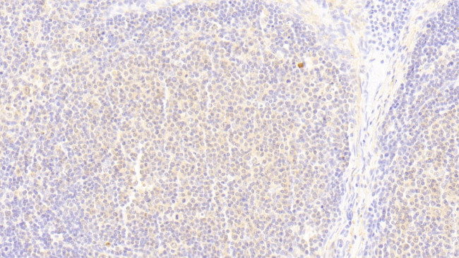 UBAP2 Antibody in Immunohistochemistry (Paraffin) (IHC (P))