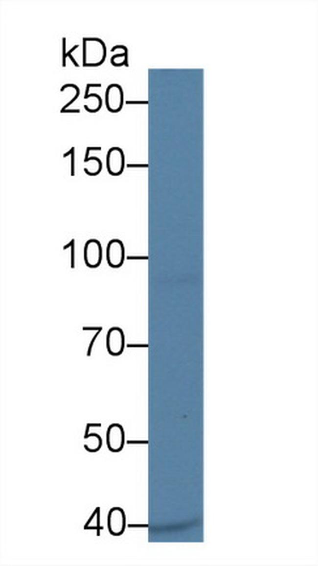 UBAP2 Antibody in Western Blot (WB)