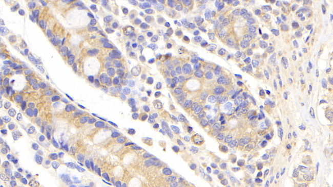 UBE2S Antibody in Immunohistochemistry (Paraffin) (IHC (P))