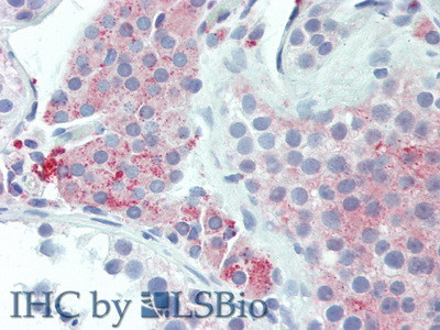 UCN2 Antibody in Immunohistochemistry (Paraffin) (IHC (P))