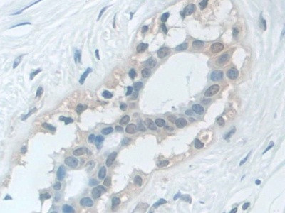 VCP Antibody in Immunohistochemistry (Paraffin) (IHC (P))