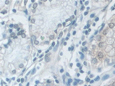 VCP Antibody in Immunohistochemistry (Paraffin) (IHC (P))