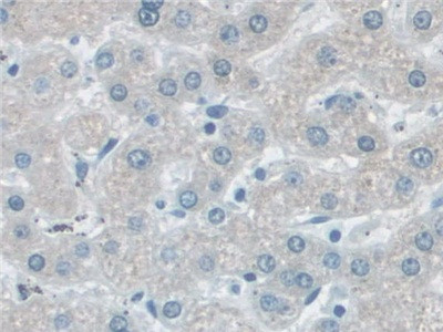 VCP Antibody in Immunohistochemistry (Paraffin) (IHC (P))