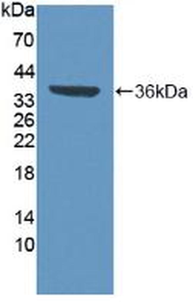 VCP Antibody in Western Blot (WB)