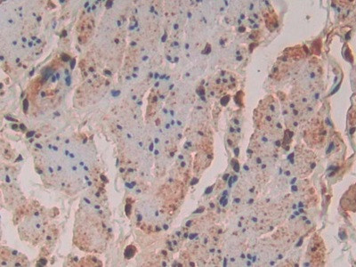 VAV3 Antibody in Immunohistochemistry (Paraffin) (IHC (P))