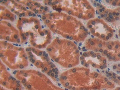 VAV3 Antibody in Immunohistochemistry (Paraffin) (IHC (P))