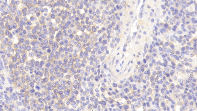 WASP Antibody in Immunohistochemistry (Paraffin) (IHC (P))