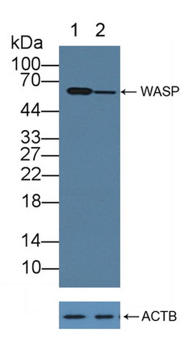 WASP Antibody in Western Blot (WB)