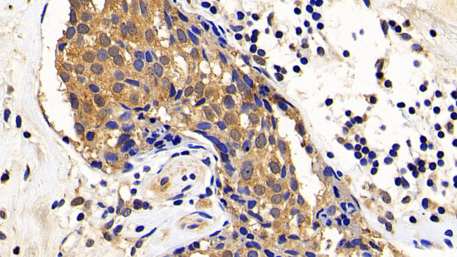 XIAP Antibody in Immunohistochemistry (Paraffin) (IHC (P))