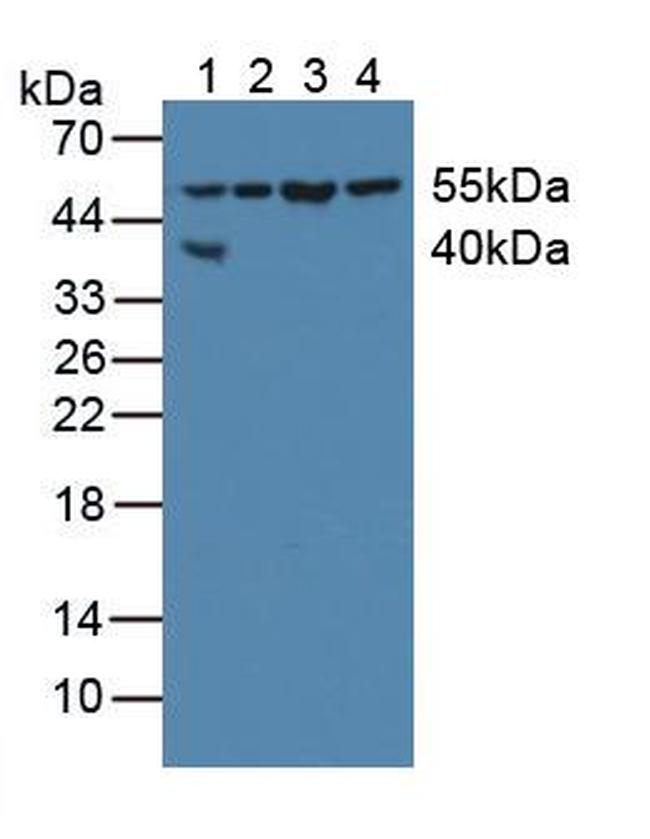 XIAP Antibody in Western Blot (WB)