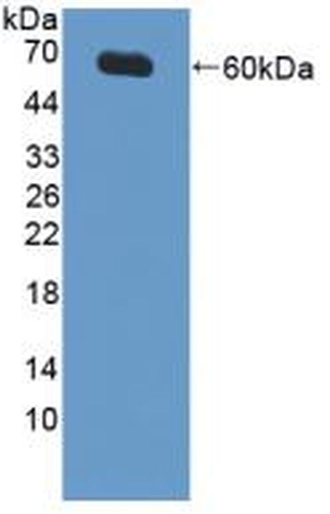 XIAP Antibody in Western Blot (WB)