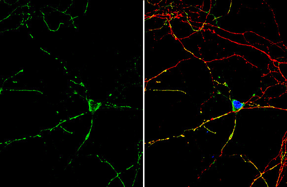 GABOB Antibody in Immunocytochemistry (ICC/IF)