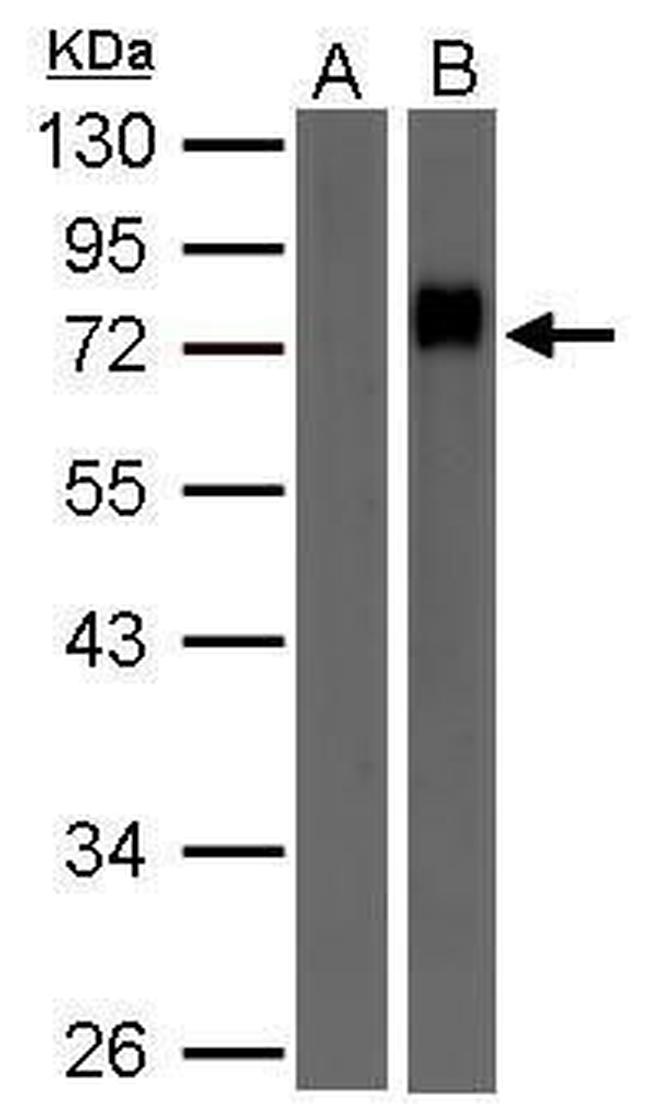 Biotin Antibody in Western Blot (WB)