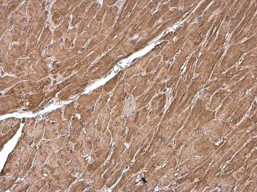 Cardiac Troponin T Antibody in Immunohistochemistry (Paraffin) (IHC (P))