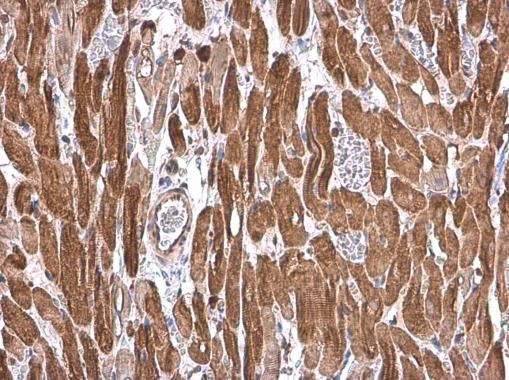 Cardiac Troponin T Antibody in Immunohistochemistry (Paraffin) (IHC (P))