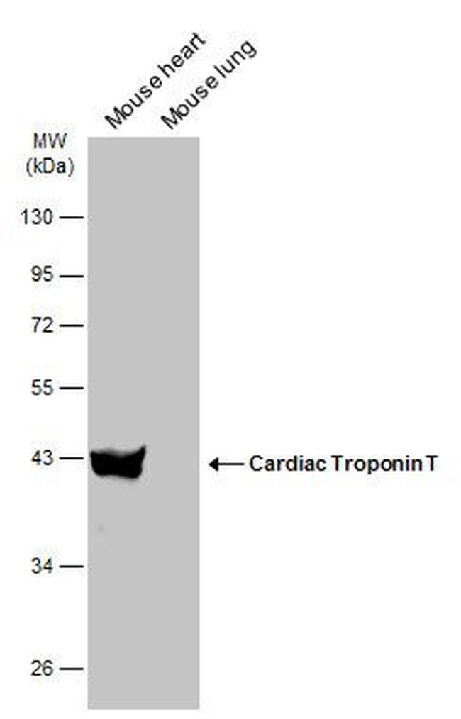 Cardiac Troponin T Antibody in Western Blot (WB)