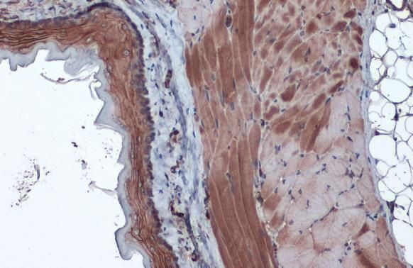 Caspase 6 (Cleaved Asp162) Antibody in Immunohistochemistry (Paraffin) (IHC (P))