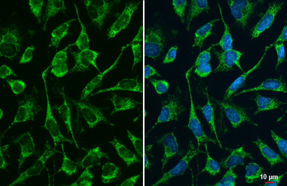 DLST Antibody in Immunocytochemistry (ICC/IF)